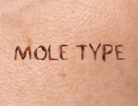 Mole Type